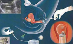 郑州医院试管试管代怀服务(郑州医院试管试管代怀服务) 郑州医院试管试管代怀服务(郑州医院试管试管代怀服务)