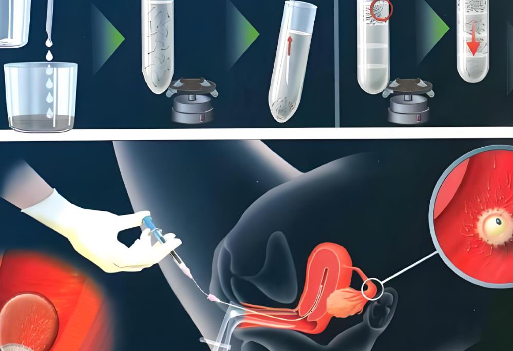 郑州助孕孩子收费10万元(郑州助孕技术对比分析)